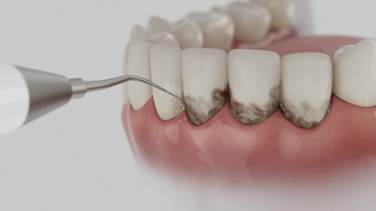 Reliable Invisalign Clear Aligners contractor in Sheridan County County, WY by Dentist Open Now